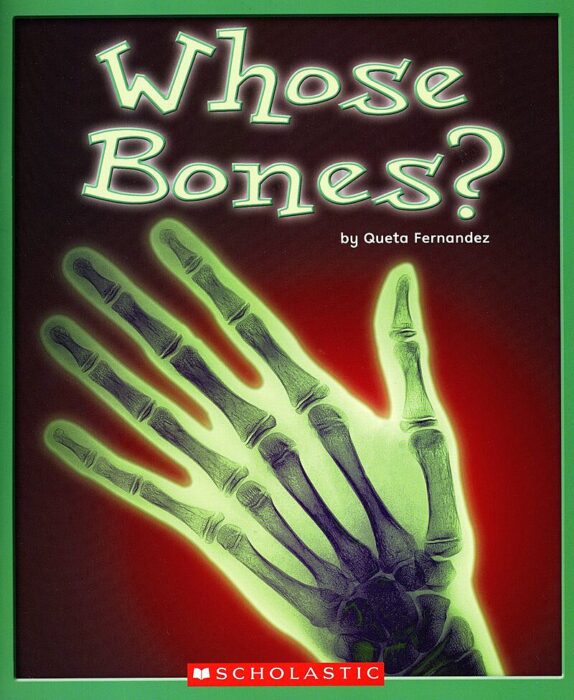 Whose Bones?