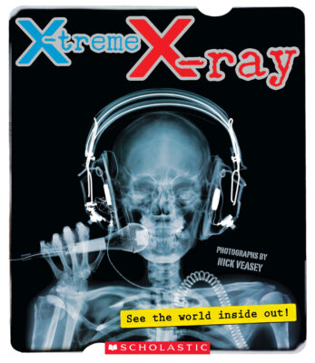 X-treme X-ray